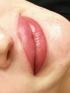 Dermatopigmentatie powder lips 5