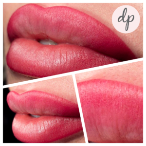 Dermatopigmentatie bardot lips 1