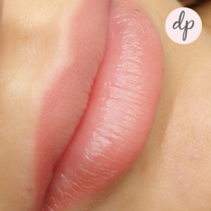 Dermatopigmentatie baby lips 2
