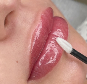 Dermatopigmentatie lippigmentatie Bardot Lips resultaat met lipgloss