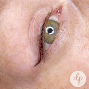 Dermatopigmentatie eyeliner Stardust video