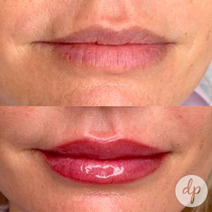 Wat is semi permanente make-up van de lippen?